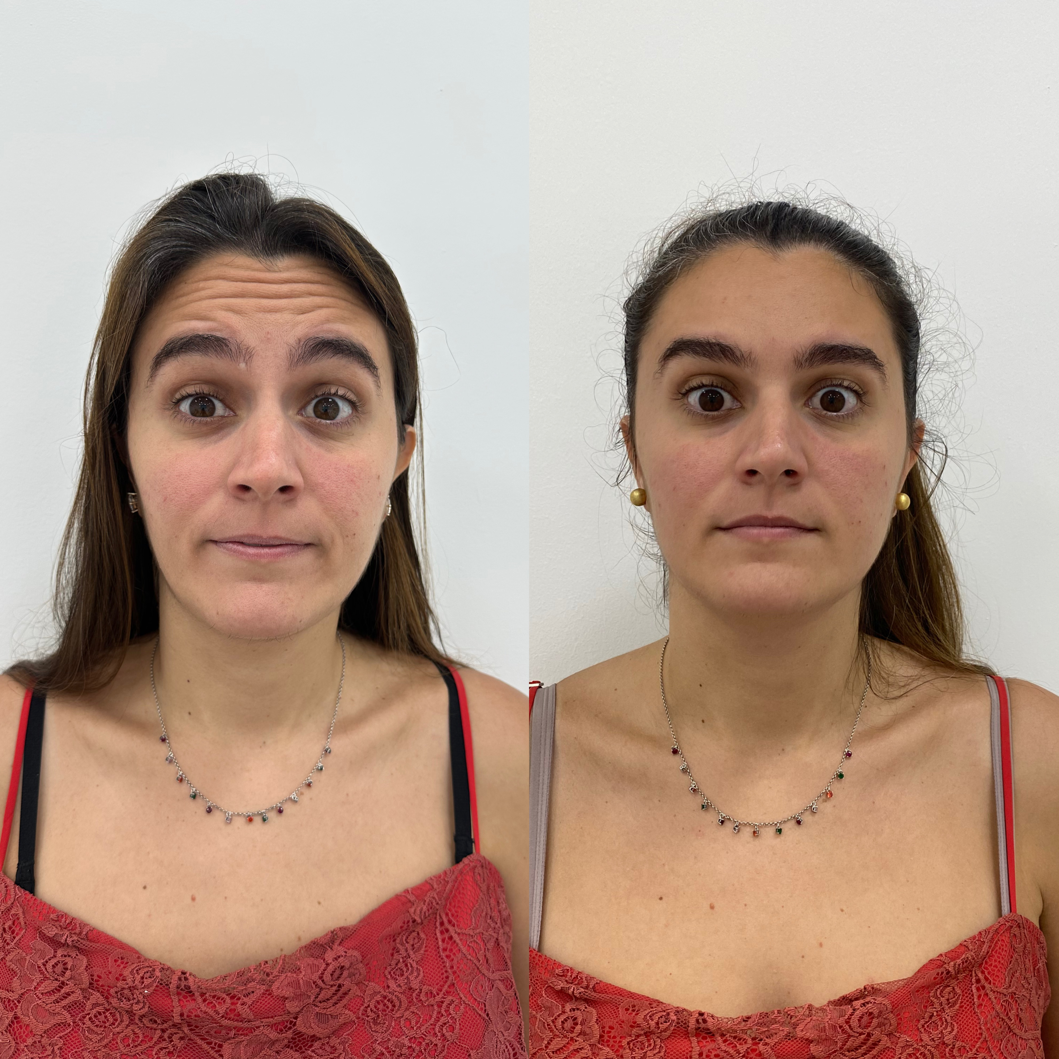 Pessoa de frente em dois registros, antes à esquerda e depois à direita.